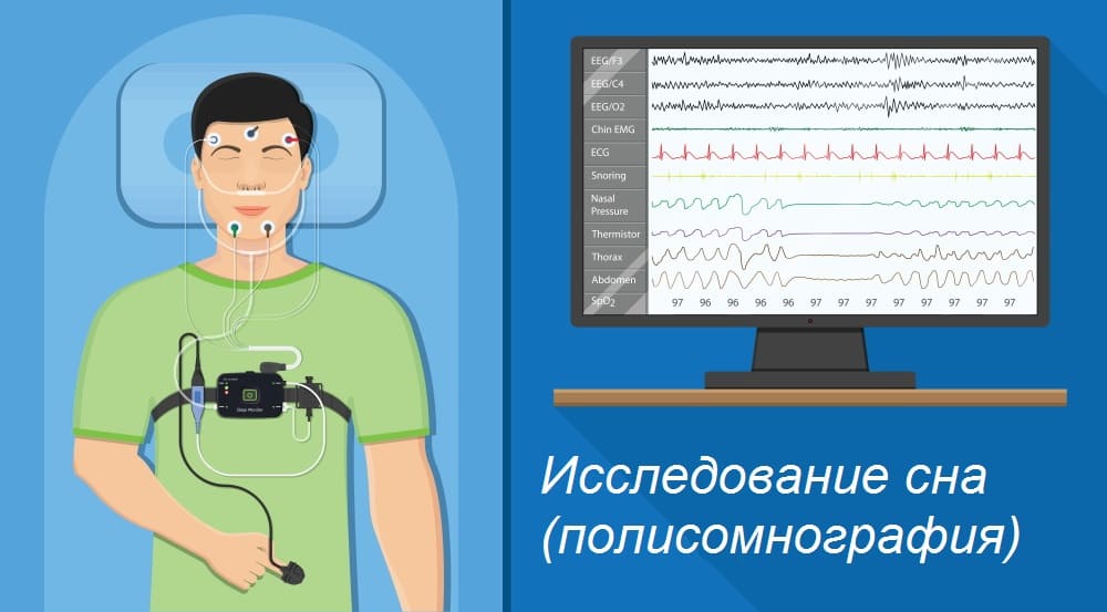 БЕССОННИЦА И ВИТАМИНЫ